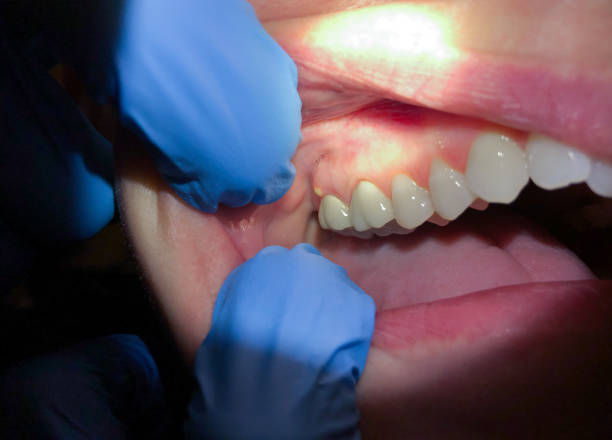 Dentist for Dental Trauma in AL