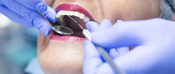 Best Affordable Emergency Dental Care  in Bon Secour, AL