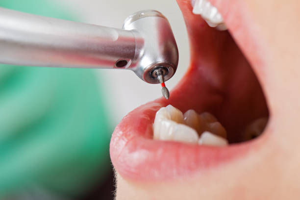 Best Tooth Pain Emergency Relief  in Bon Secour, AL